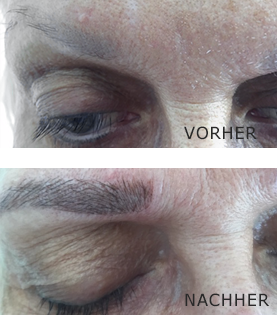 Microblading